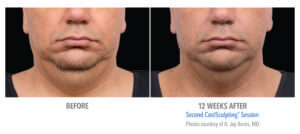 Healthy Solutions Medspa
