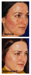 Healthy Solutions Medspa