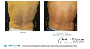 Healthy Solutions Medspa
