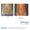 Healthy Solutions Medspa