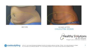 Healthy Solutions Medspa