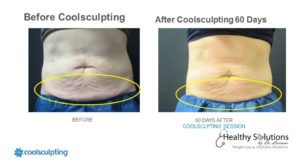 Healthy Solutions Medspa