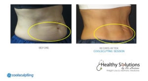Healthy Solutions Medspa