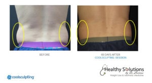 Healthy Solutions Medspa