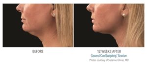 Healthy Solutions Medspa