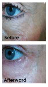 Healthy Solutions Medspa