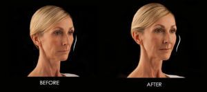 Healthy Solutions Medspa