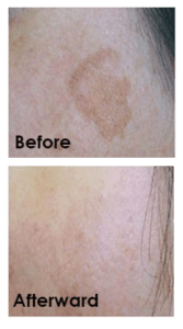 Healthy Solutions Medspa