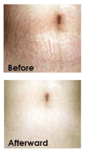 Healthy Solutions Medspa