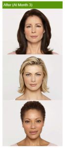 Healthy Solutions Medspa
