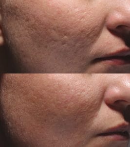 Healthy Solutions Medspa