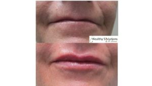 Healthy Solutions Medspa