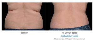 Healthy Solutions Medspa