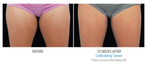 Healthy Solutions Medspa