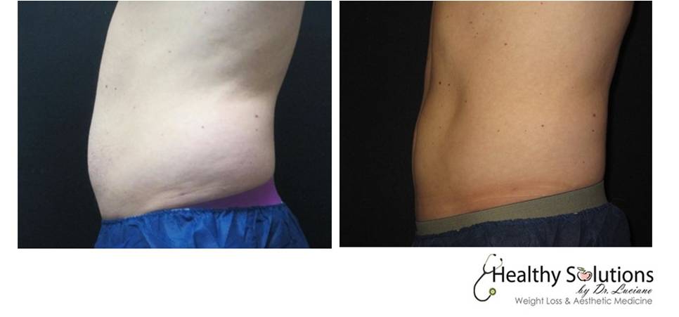 Healthy Solutions Medspa