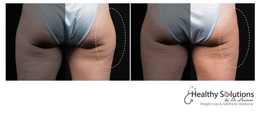 Healthy Solutions Medspa
