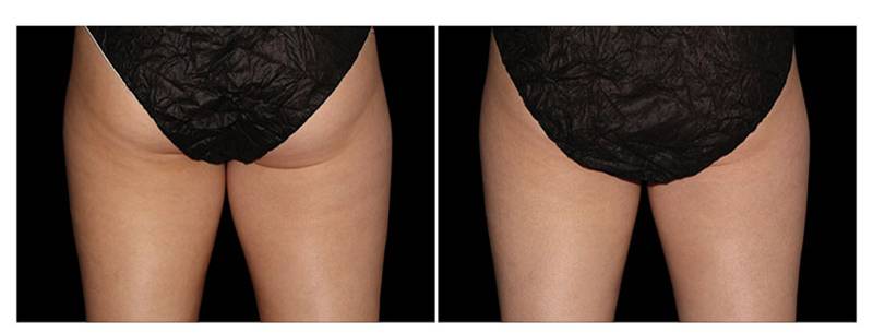 Healthy Solutions Medspa