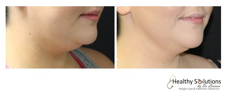 Healthy Solutions Medspa