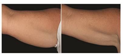 Healthy Solutions Medspa