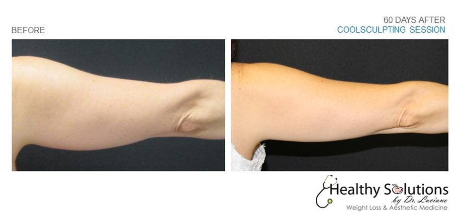 Healthy Solutions Medspa