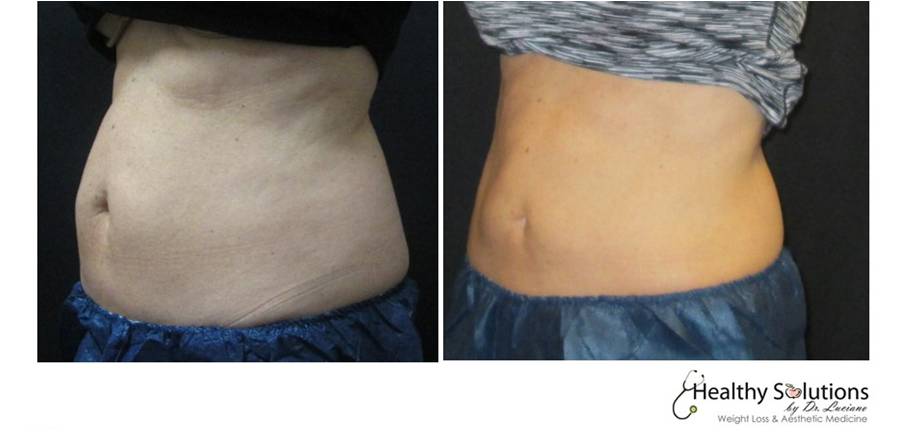 Healthy Solutions Medspa