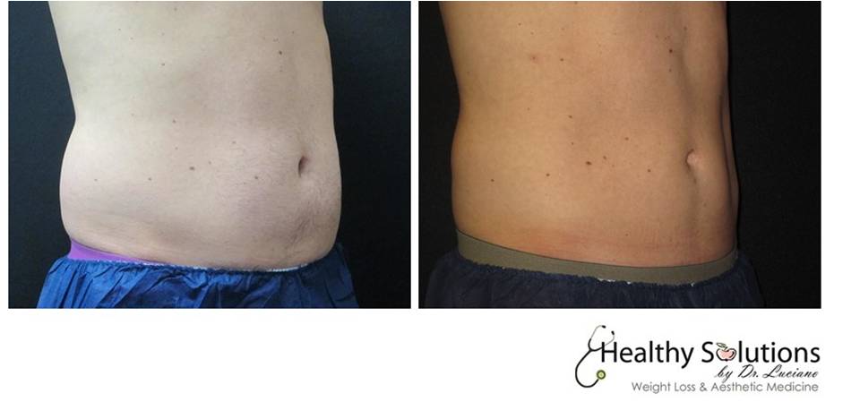 Healthy Solutions Medspa