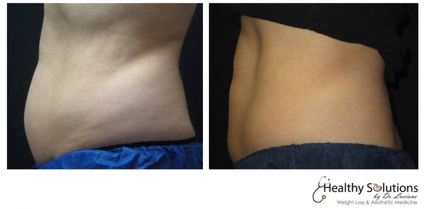 Healthy Solutions Medspa
