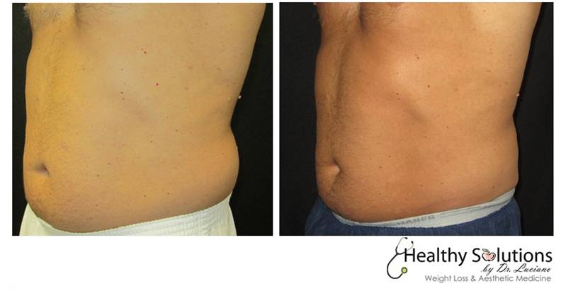 Healthy Solutions Medspa