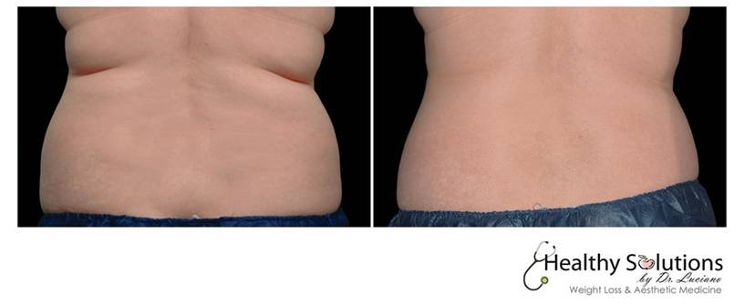 Healthy Solutions Medspa