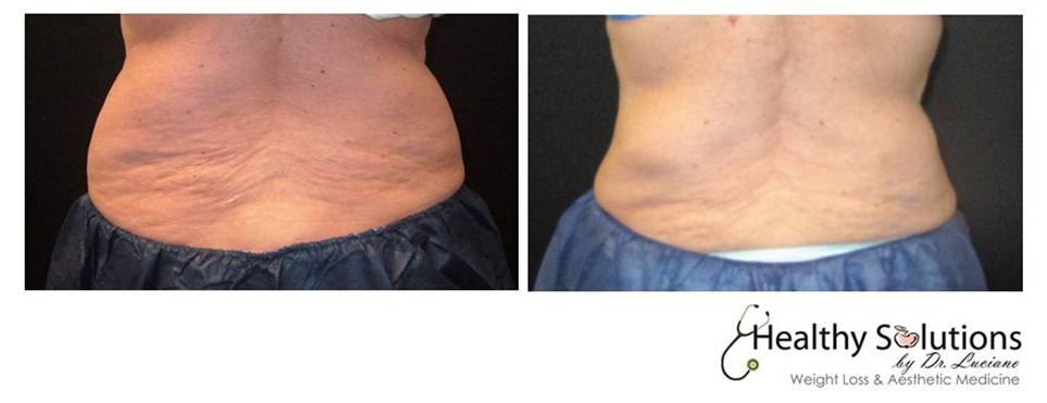 Healthy Solutions Medspa