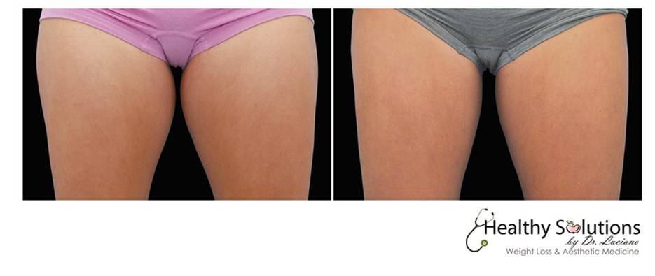 Healthy Solutions Medspa