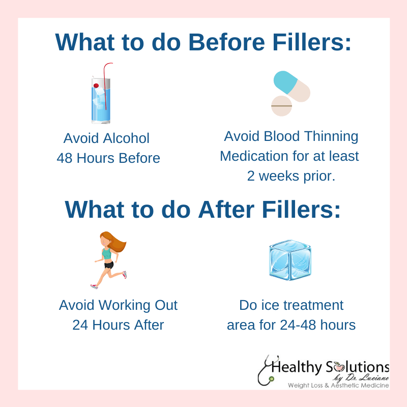 dermal fillers