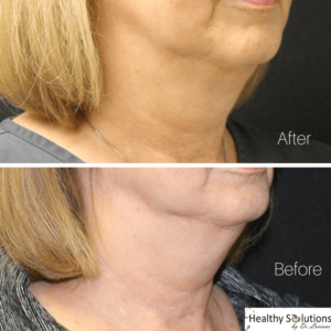 Healthy Solutions Medspa