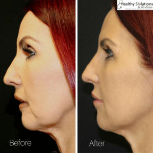 Healthy Solutions Medspa