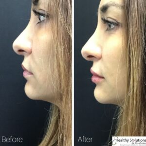 Healthy Solutions Medspa