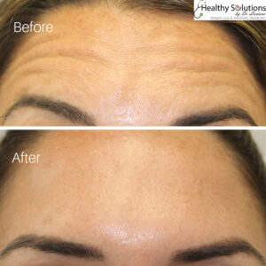 Healthy Solutions Medspa