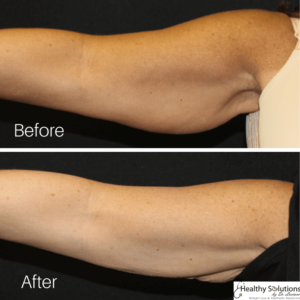 Healthy Solutions Medspa
