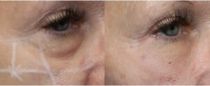 Healthy Solutions Medspa
