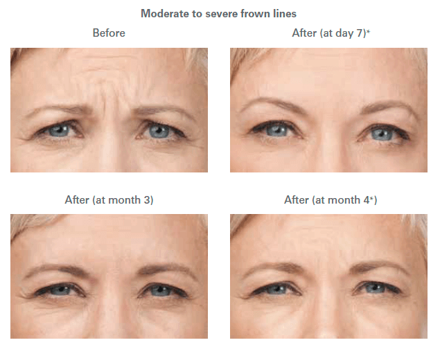 Healthy Solutions Medspa