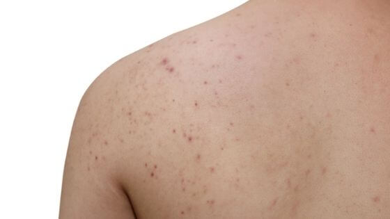 Healthy Solutions Medspa