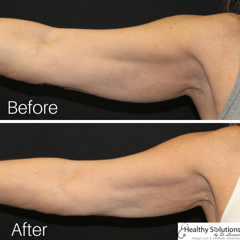 Healthy Solutions Medspa