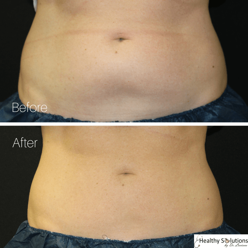 Healthy Solutions Medspa