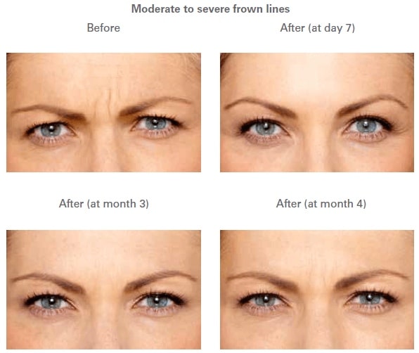 Healthy Solutions Medspa