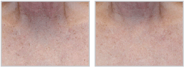 Healthy Solutions Medspa