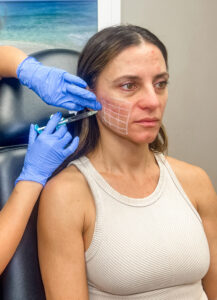 skinvive