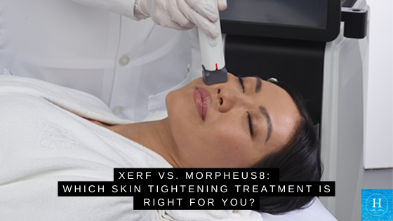 XERF vs. Morpheus 8: Which Skin Tightening Treatment Is Right for You?