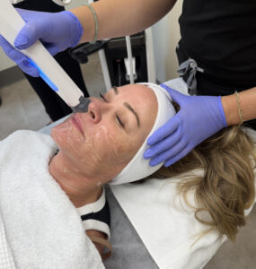 Xerf skin tightening at Healthy Solutions Medspa