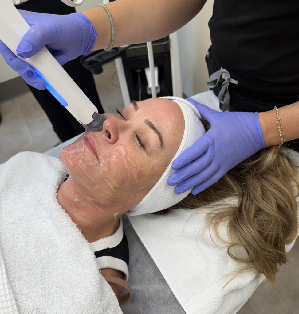 Xerf skin tightening at Healthy Solutions Medspa