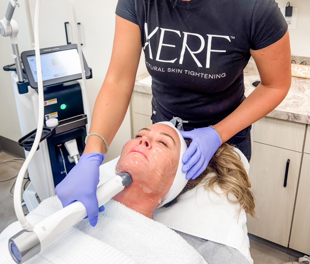 How to Tighten Loose Skin Without Surgery: Your Guide to Non-Surgical Skin Tightening